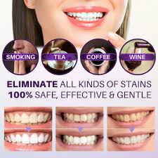 Hismile Instant Teeth Whitening