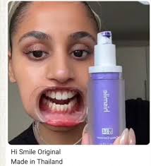 Hismile Instant Teeth Whitening